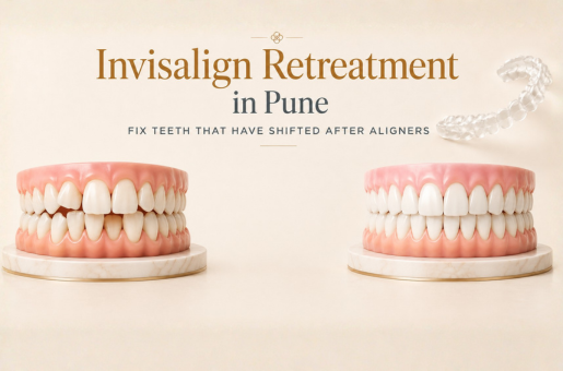 Invisalign Retreatment in Pune: Fix Teeth That Have Shifted After Aligners